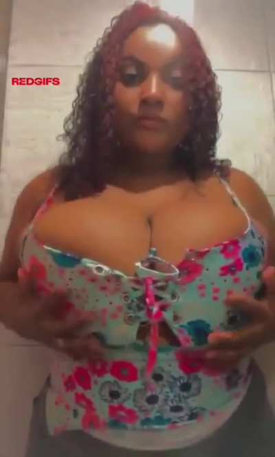 Massive areolas