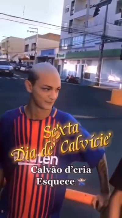 Ser calvo t&aacute; no hype