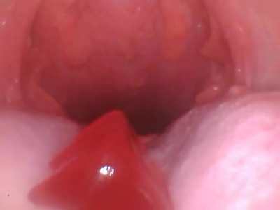 Gummy swallow &amp;lt;3