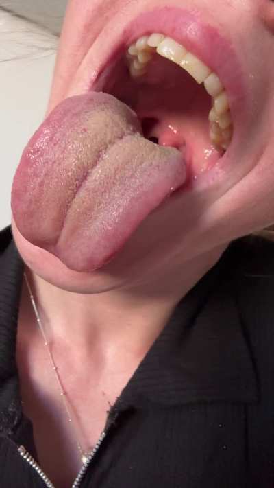 Believe me, I brush my teeth, but the coffee I drink every day needs to be cleaned off my tongue... volunteers