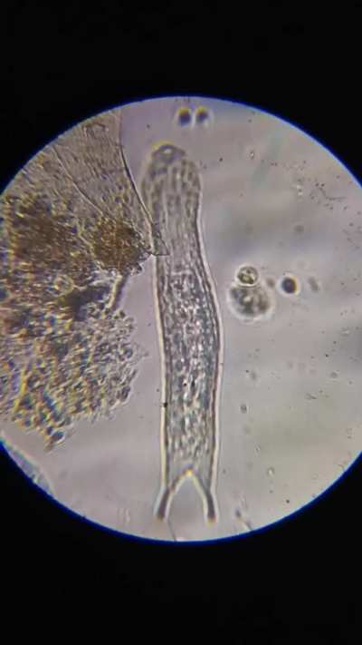 Wierd micro planaria thingy