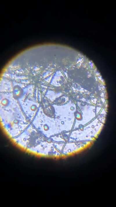 From a saltwater pool at likely 300x (sorry for the poor quality). Anyone have any clue what it is?