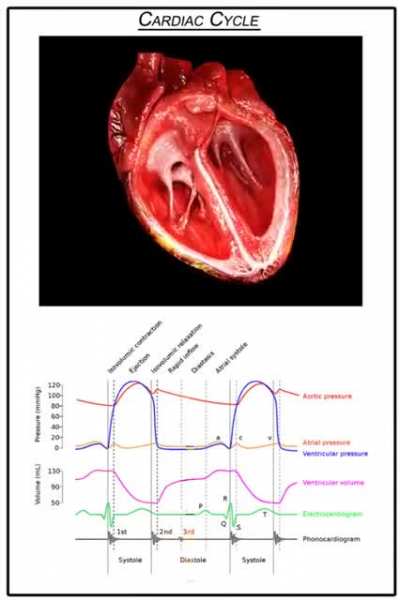 Very nice graph for everyone who is interrested in Cardio.