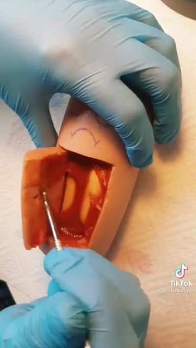 The miracle of life