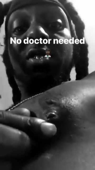 Go to the doctor you might live! shiiiidd ima take my chances.....and do it myself