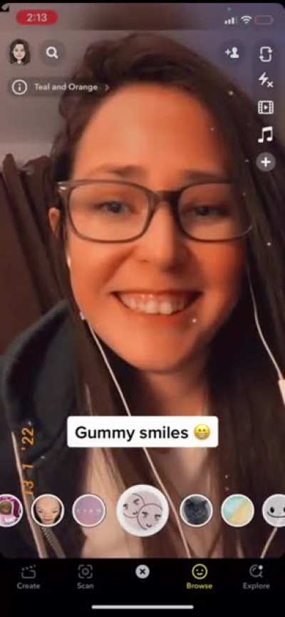 Gummy Smile