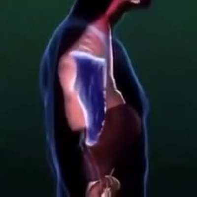 Pyrocynical
