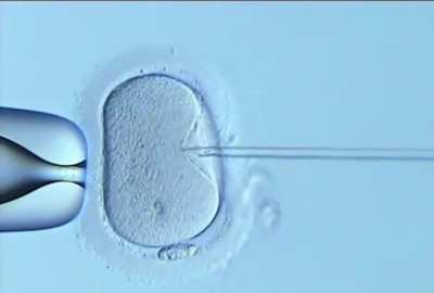 Sperm being inserted directly into the egg in laboratory &hellip;