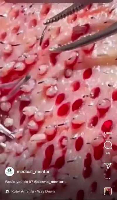 Thanks, I hate it