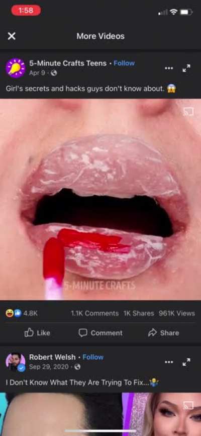 Just when you thought overfilled lips couldn&rsquo;t get any worse