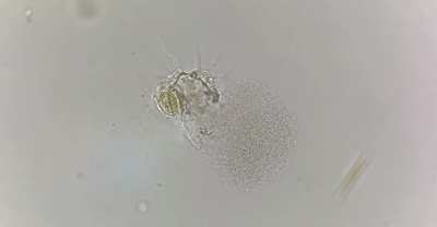 A single cell organism dying