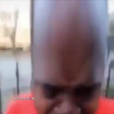 Forehead