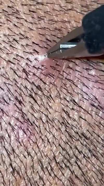 EEE-