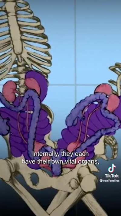 conjoined lives