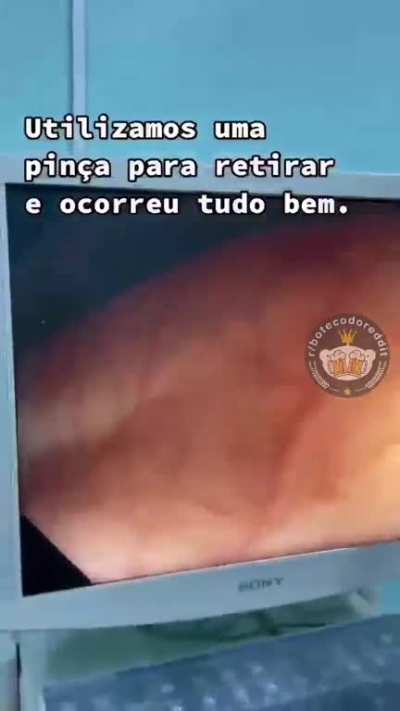 T&aacute;, quem foi?