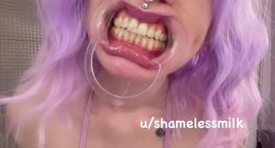 Drooling from my Dental Gape