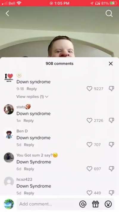 Down syndrome
