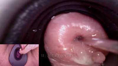 cervix sounding up close