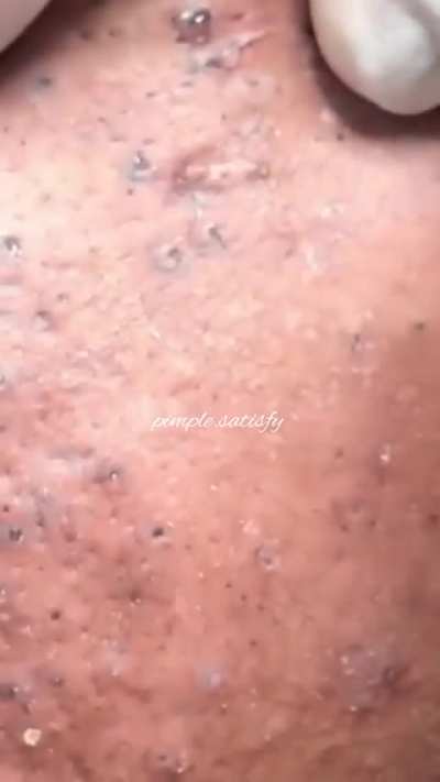 .........