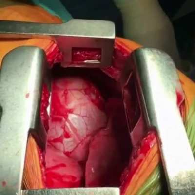 A stabbing victim had an extremely close call