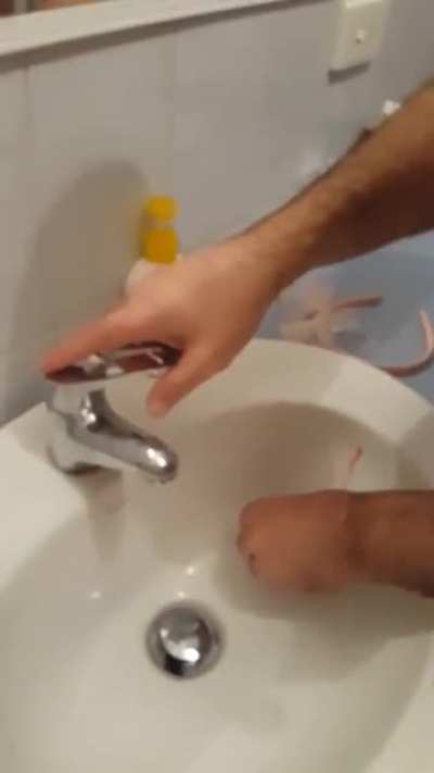 Big cyst on face exploding