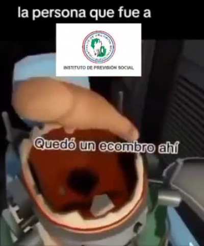 XD