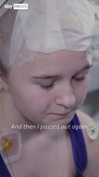 (Follow Up) A little girl has survived a piece of shrapnel embedded into her brain, and removed by one of Ukraine 's top neurosurgeons