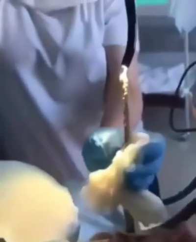 Medics pull 4ft snake from woman’s mouth after it slithered down there while she slept.