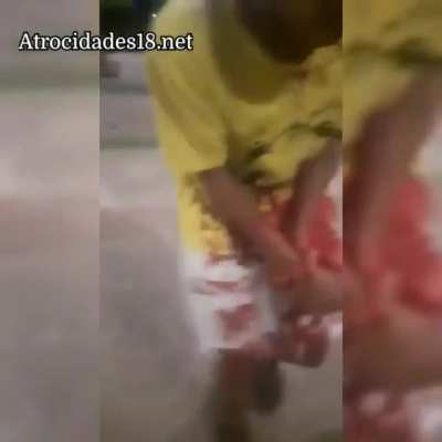 Machete flight ends in permanent damage