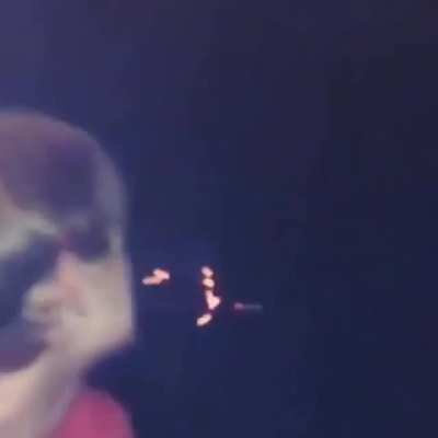 His burnt face