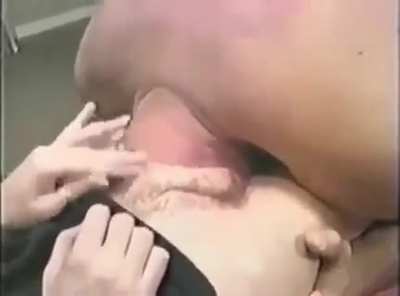 Vulkan