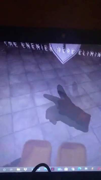 MY HANDS!!!
