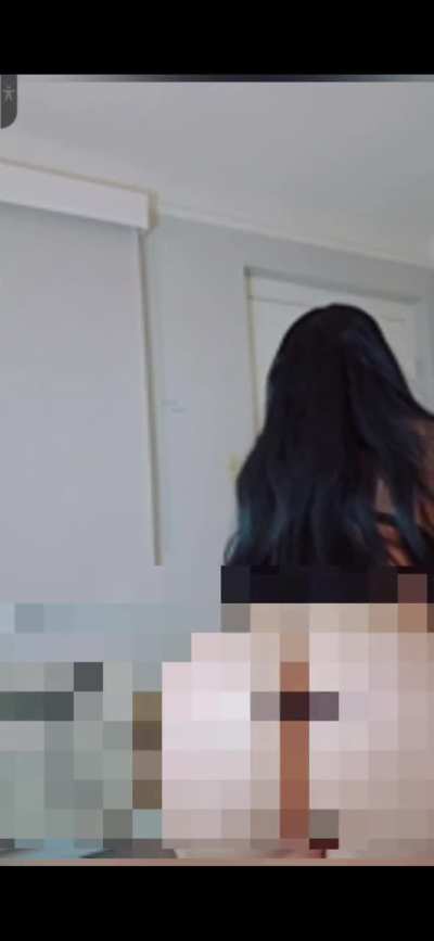 ( Alertz ) mira como quedaron sus nalgotas después de la cirugía