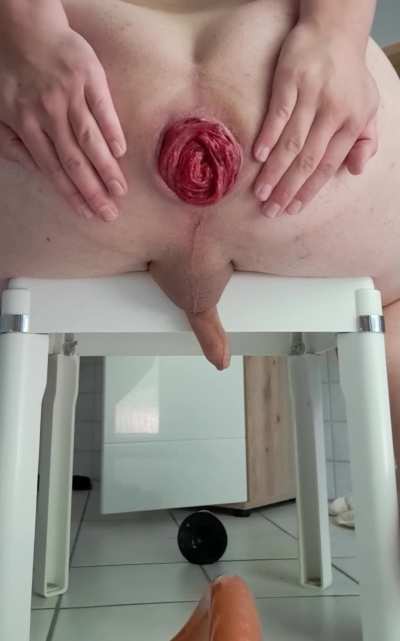 Prolapsing good enough to piss