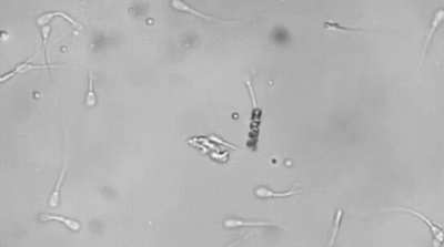 "You were the strongest and fastest of millions of sperm" My lazy ass:
