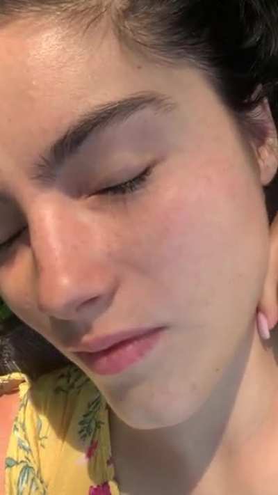 freckles in the sunlight