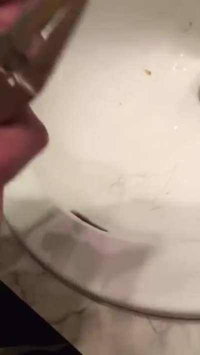 Relieving pressure from a smashed fingernail