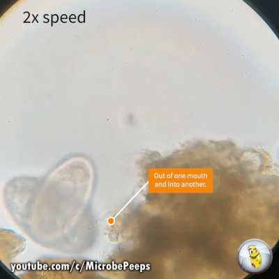 Vorticella's very bad day