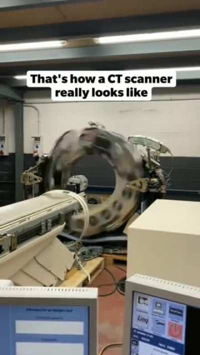 This is how CT scanner works..