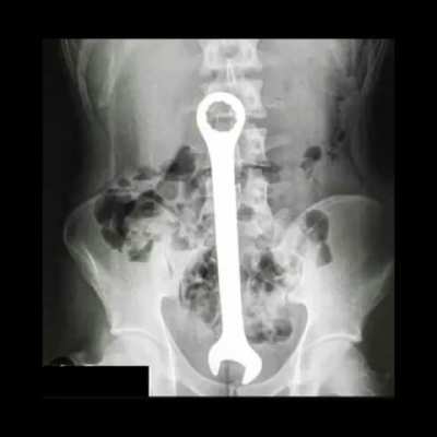 blursed_xray