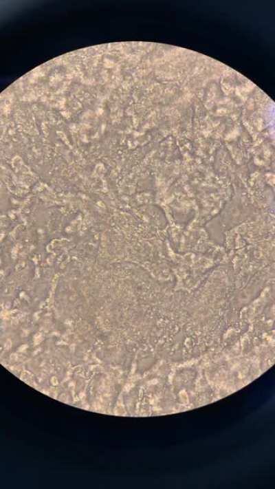 Beating cardic cells in culture. This is as close to magic as it gets 💛