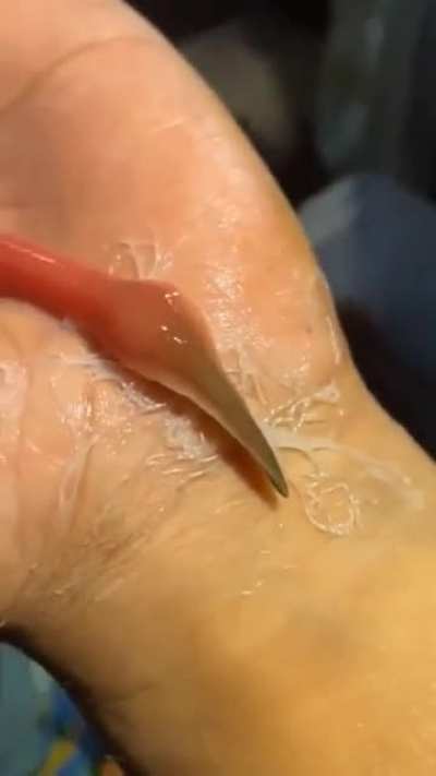 WTF IS THAT WORM
