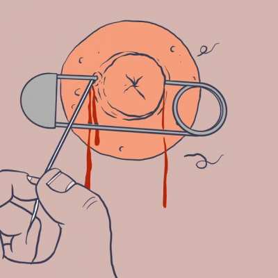Thanks, I hate it this animation.
