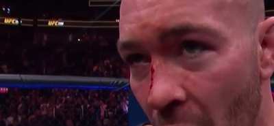 &ldquo;nOt a ScrAtcH oN mE BrO&rdquo;