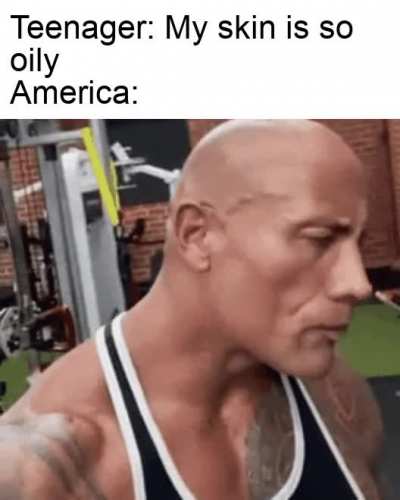 Time to conquer some forehead
