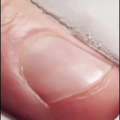 Nail growing