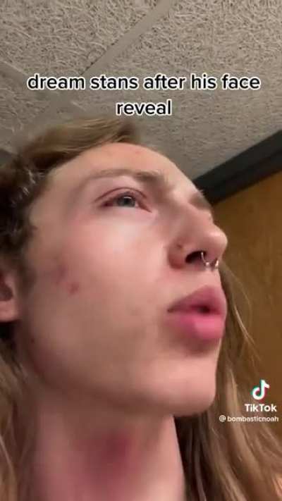No one is ever doing a face reveal ever again at this rate
