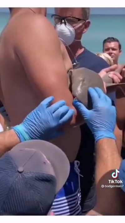 Only in America: A sea monster bites you but you refuse the ambulance because you can't afford the medical bills