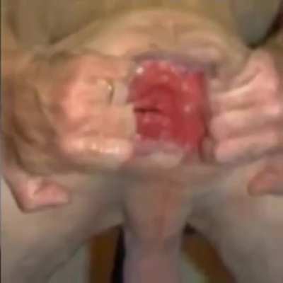 That prolapse is really talented!