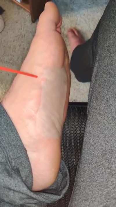 cursed_skin-balloon